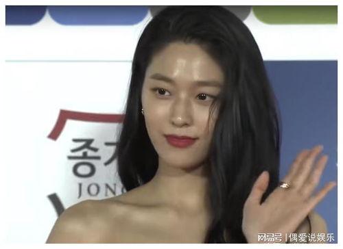 带假牙的韩国明星,揭秘带假牙的韩国明星风采